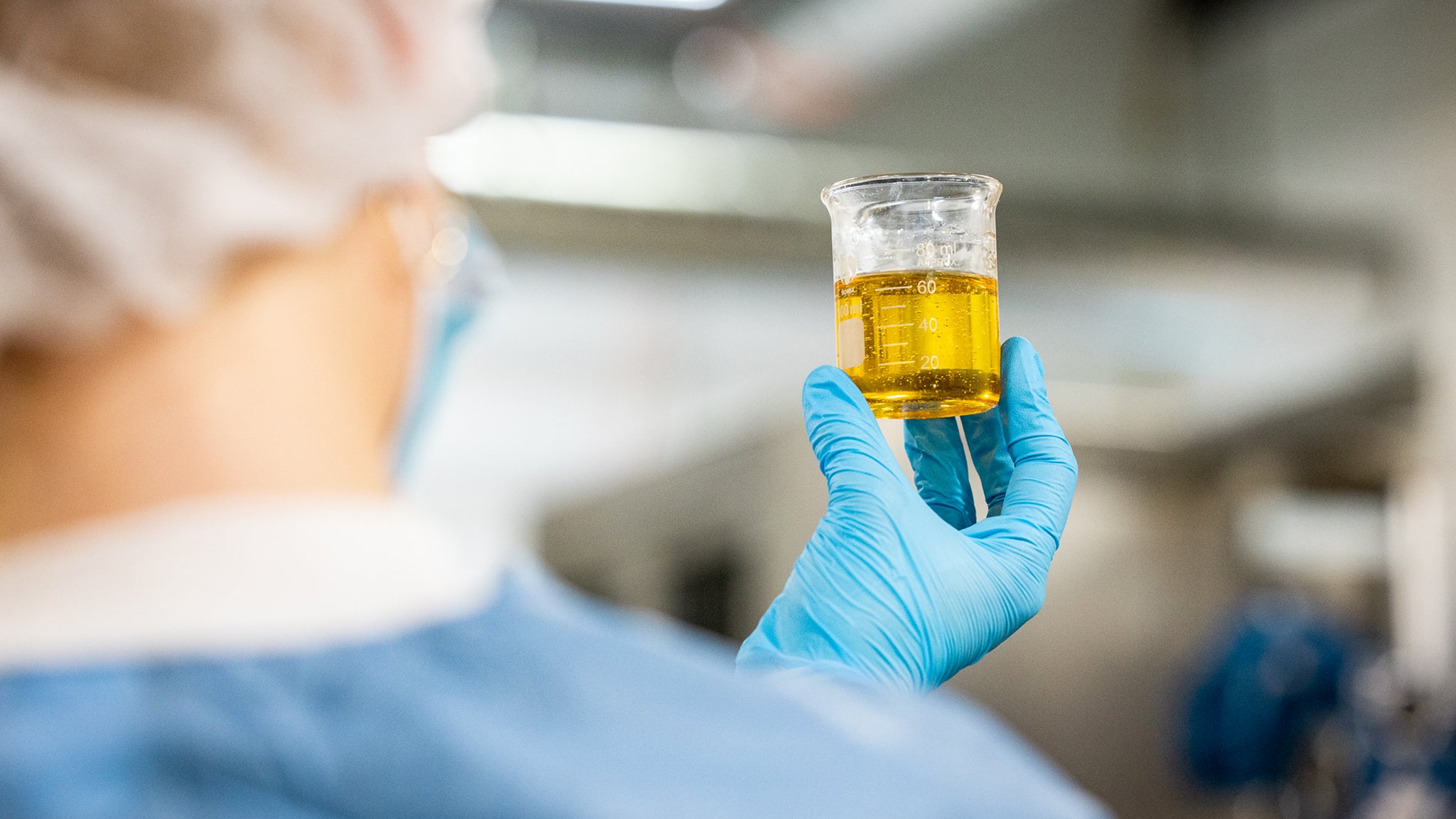 A laboratory technician wearing blue gloves and a protective cap holds up a glass beaker containing a golden-yellow liquid for inspection in a lab setting.